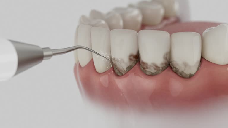Reliable Dental contractor in De Graff, OH by Dentist Open Now